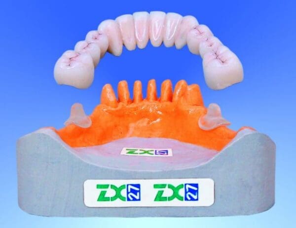 HYPODENT ZX-27 GLASS ABUTMENT SMALL